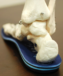 banner_orthotics02